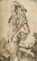 Standing flayed cadaver, rear view]