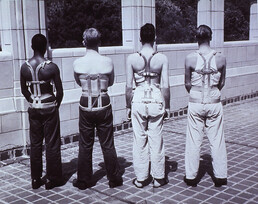 Orthopedic apparatus: Spondylitic braces